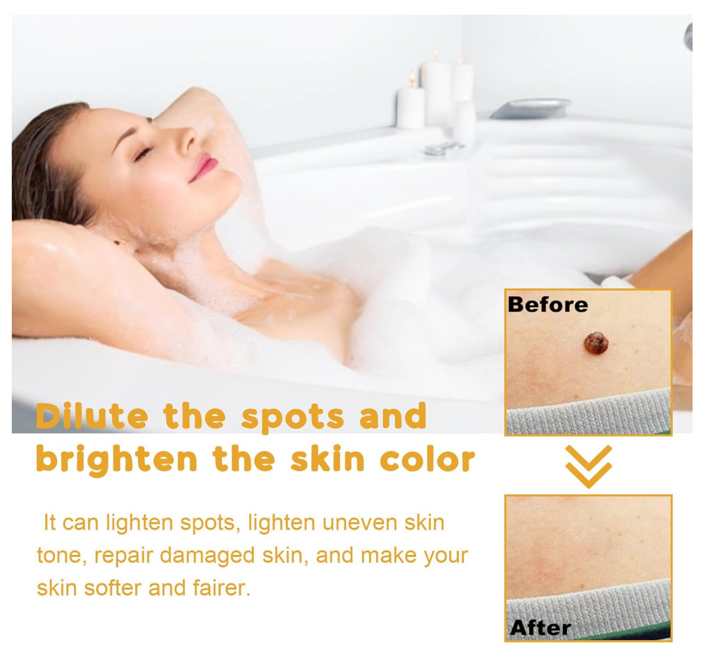 Tag Recede Eliminador de verrugas