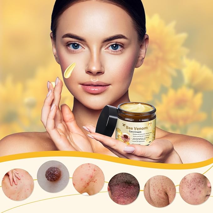 Veneno De Abeja, Crema Para El Cuidado De Tú Piel